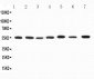 Anti-Kv1.1 Potassium Channel Antibody